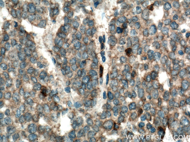 CA4 Antibody in Immunohistochemistry (Paraffin) (IHC (P))