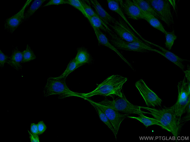 Calponin 1 Antibody in Immunocytochemistry (ICC/IF)