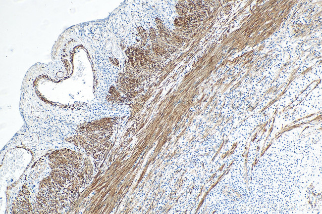 Calponin 1 Antibody in Immunohistochemistry (Paraffin) (IHC (P))