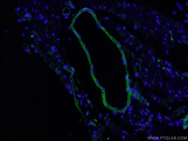 Calponin 1 Antibody in Immunohistochemistry (PFA fixed) (IHC (PFA))