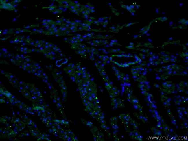 Calponin 1 Antibody in Immunohistochemistry (PFA fixed) (IHC (PFA))