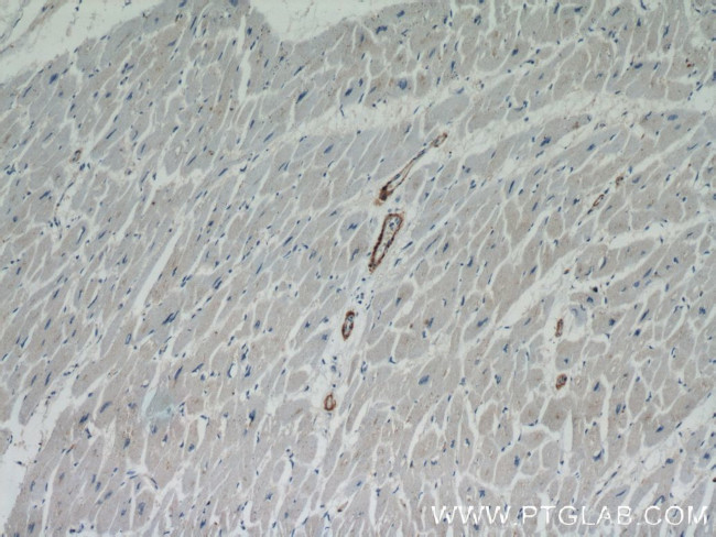 Calponin 1 Antibody in Immunohistochemistry (Paraffin) (IHC (P))