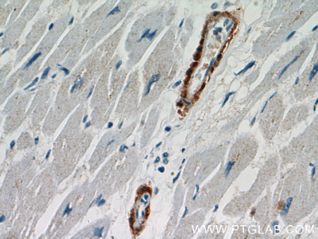 Calponin 1 Antibody in Immunohistochemistry (Paraffin) (IHC (P))