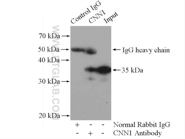 Calponin 1 Antibody in Immunoprecipitation (IP)