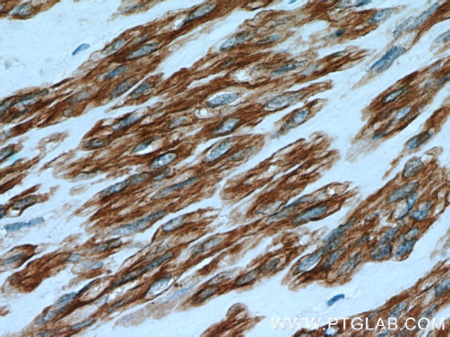 Calponin 1 Antibody in Immunohistochemistry (Paraffin) (IHC (P))