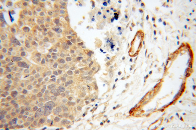 Calponin 1 Antibody in Immunohistochemistry (Paraffin) (IHC (P))