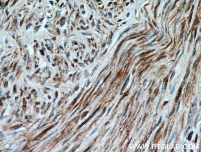 Calponin 1 Antibody in Immunohistochemistry (Paraffin) (IHC (P))