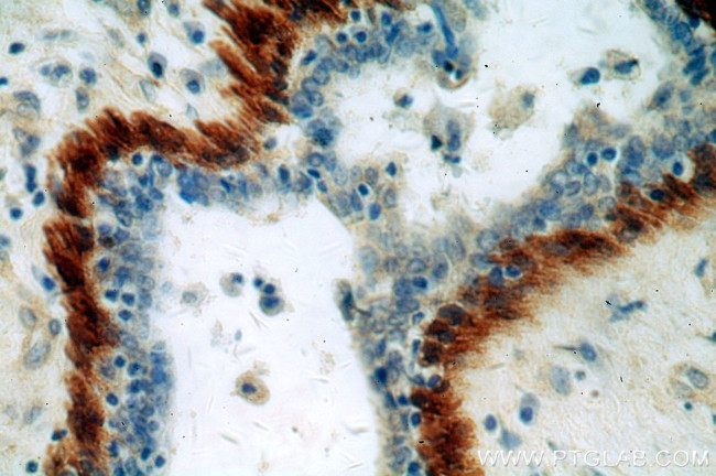 Calponin 1 Antibody in Immunohistochemistry (Paraffin) (IHC (P))