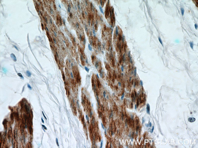 Calponin 1 Antibody in Immunohistochemistry (Paraffin) (IHC (P))