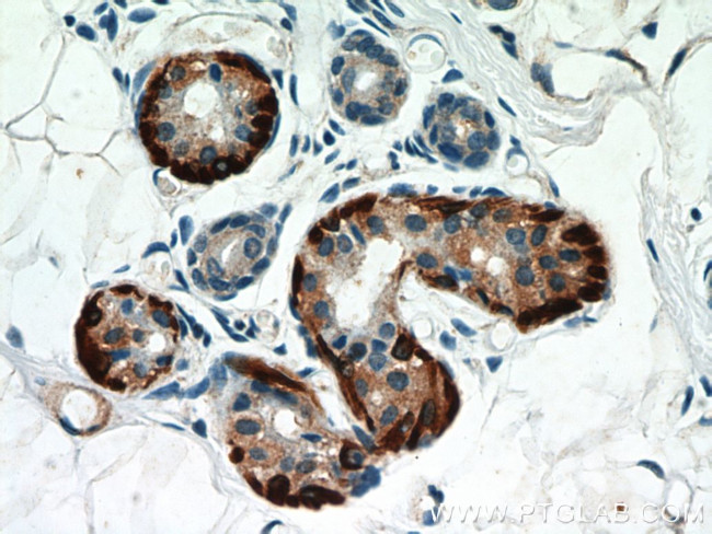 Calponin 1 Antibody in Immunohistochemistry (Paraffin) (IHC (P))