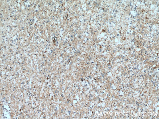 PGM2L1 Antibody in Immunohistochemistry (Paraffin) (IHC (P))