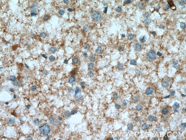 PGM2L1 Antibody in Immunohistochemistry (Paraffin) (IHC (P))