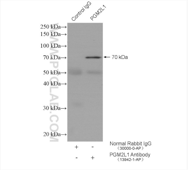 PGM2L1 Antibody in Immunoprecipitation (IP)
