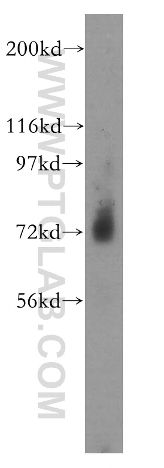 PGM2L1 Antibody in Western Blot (WB)