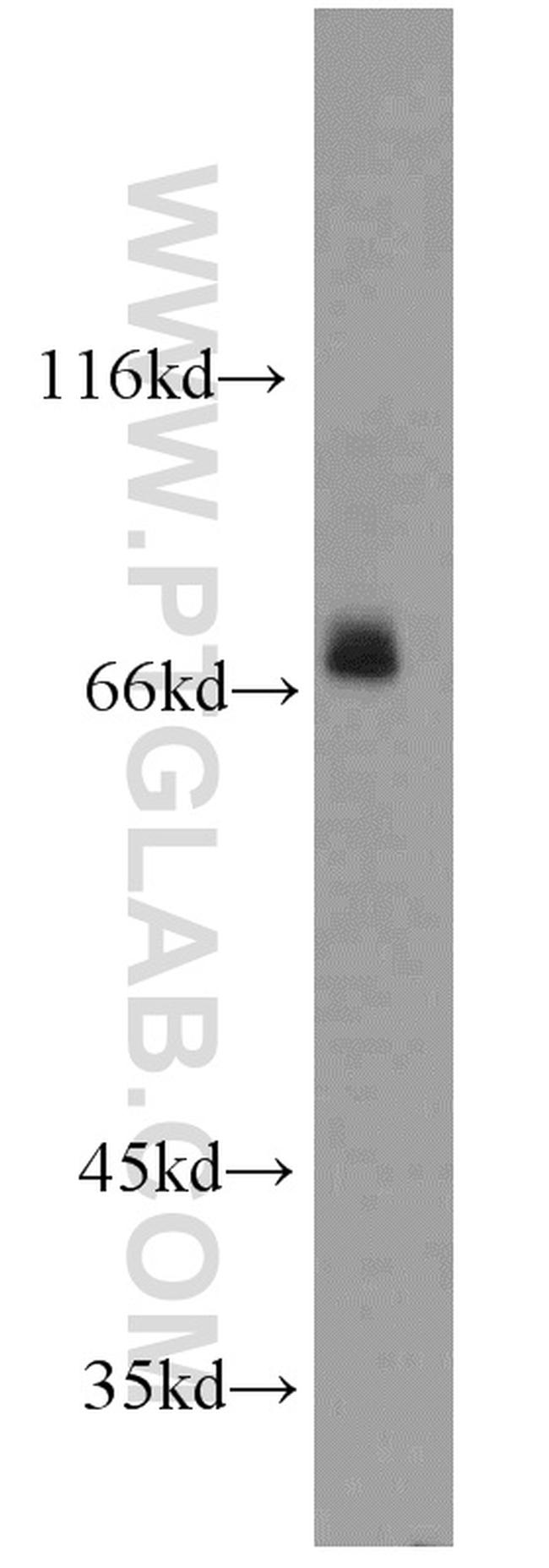 PGM2L1 Antibody in Western Blot (WB)