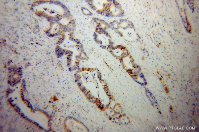 SCNN1G Antibody in Immunohistochemistry (Paraffin) (IHC (P))