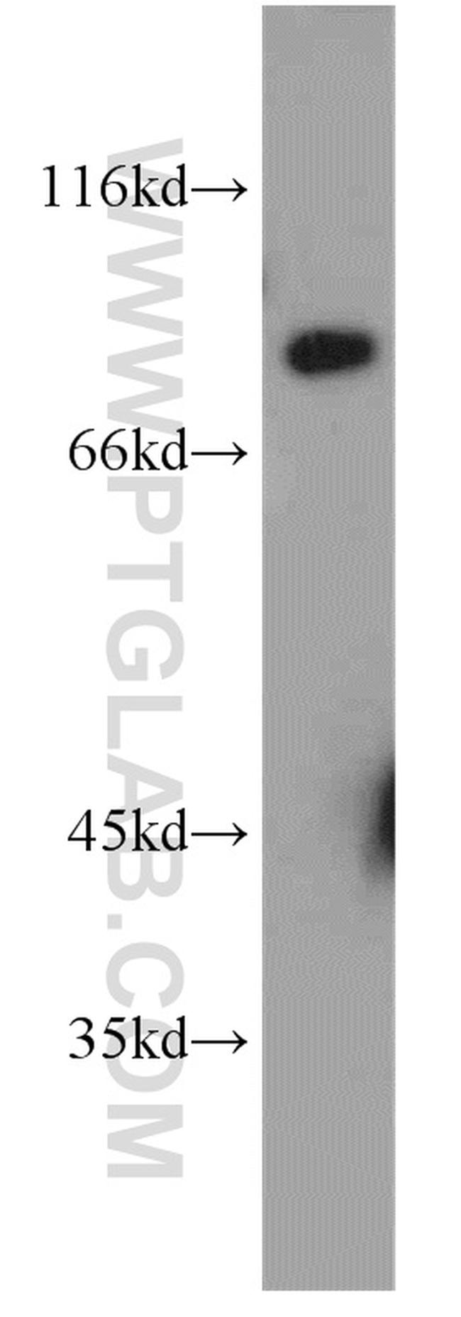 SCNN1G Antibody in Western Blot (WB)