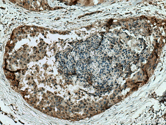 MAPKAPK2 Antibody in Immunohistochemistry (Paraffin) (IHC (P))