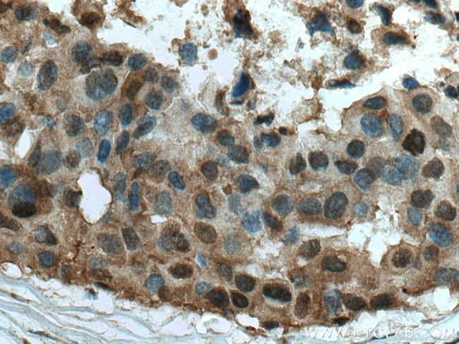 MAPKAPK2 Antibody in Immunohistochemistry (Paraffin) (IHC (P))