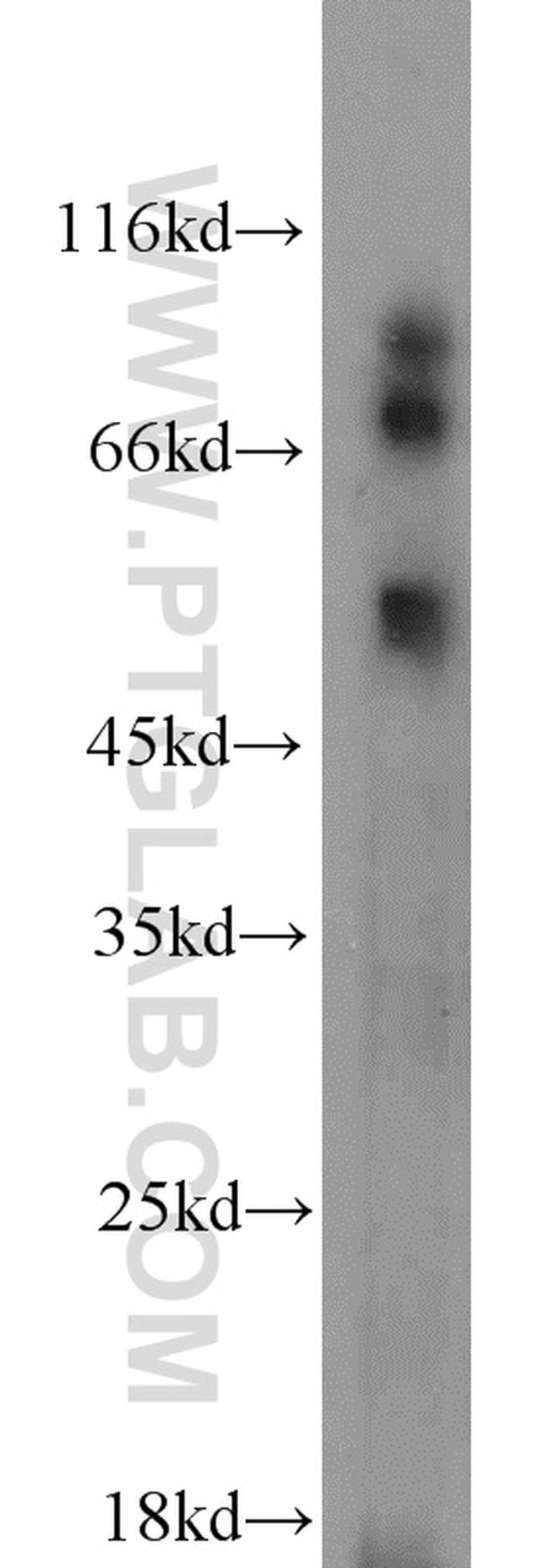 MAPKAPK2 Antibody in Western Blot (WB)