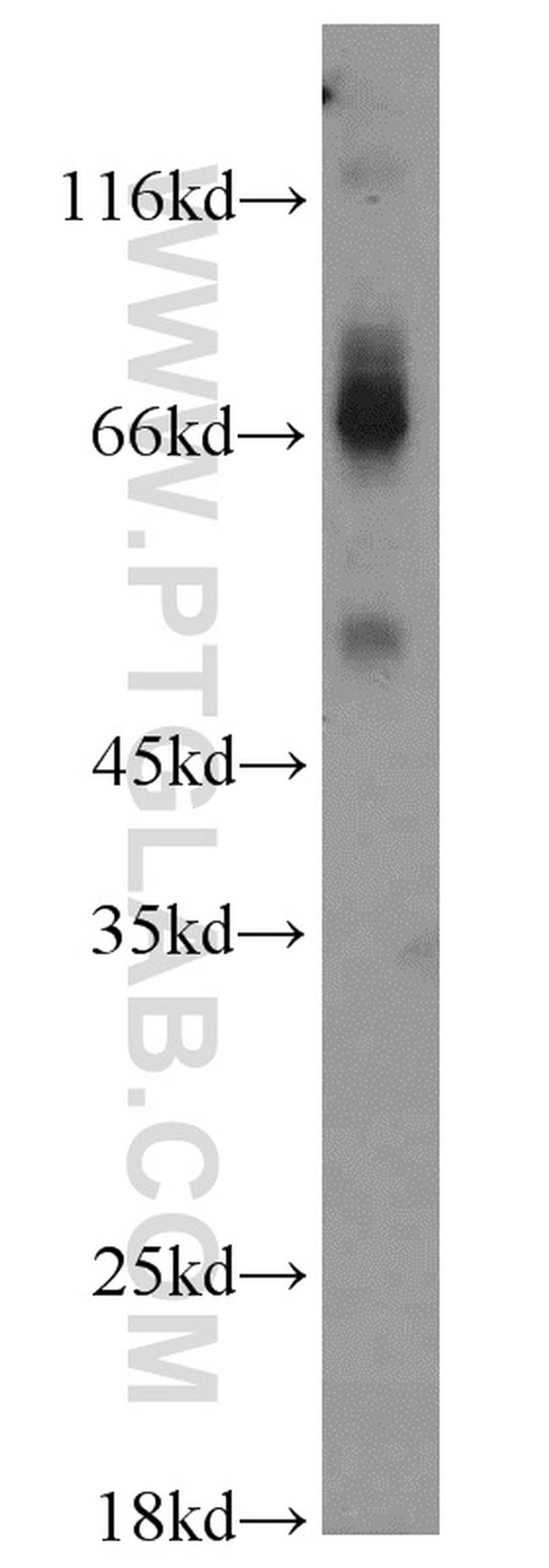 MAPKAPK2 Antibody in Western Blot (WB)