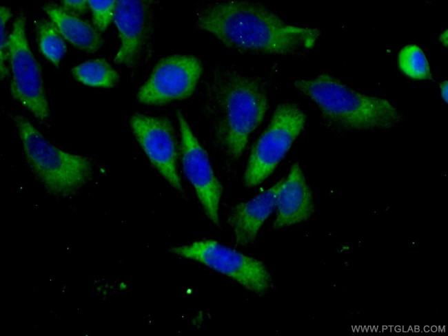 ABCF1 Antibody in Immunocytochemistry (ICC/IF)