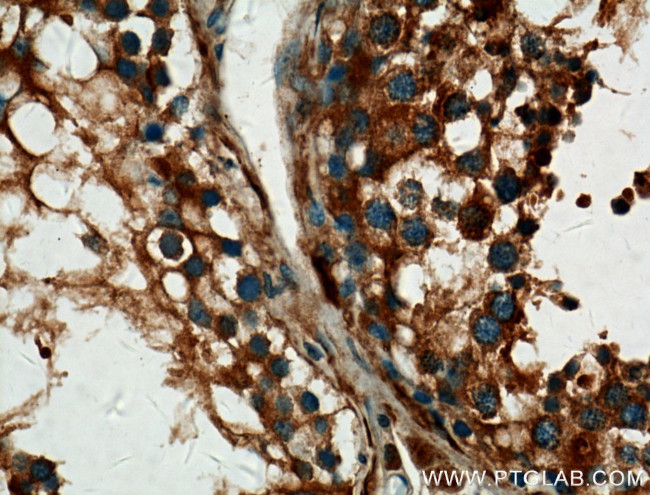 ALDH1A2 Antibody in Immunohistochemistry (Paraffin) (IHC (P))