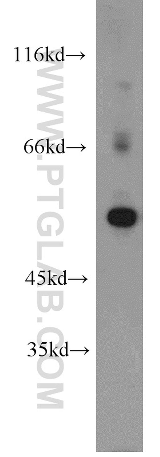 ALDH1A2 Antibody in Western Blot (WB)