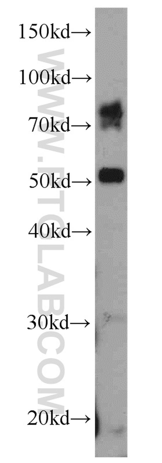 ADAM2 Antibody in Western Blot (WB)