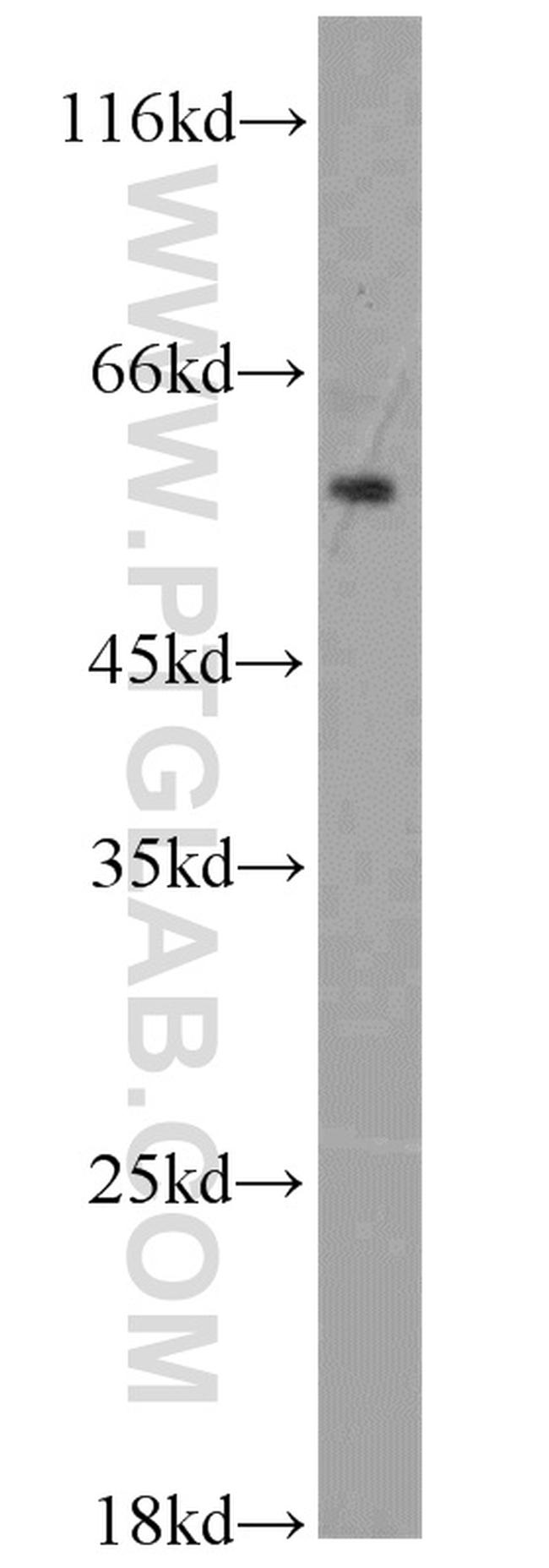 ADAM2 Antibody in Western Blot (WB)