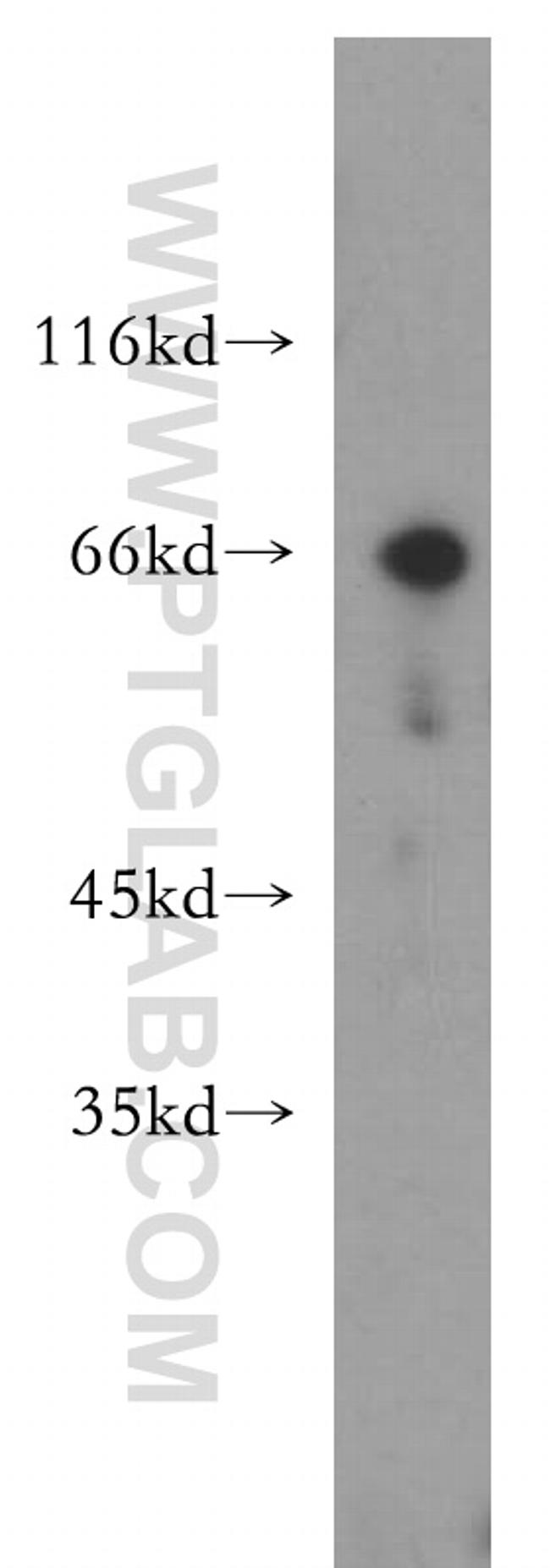Chk2 Antibody in Western Blot (WB)