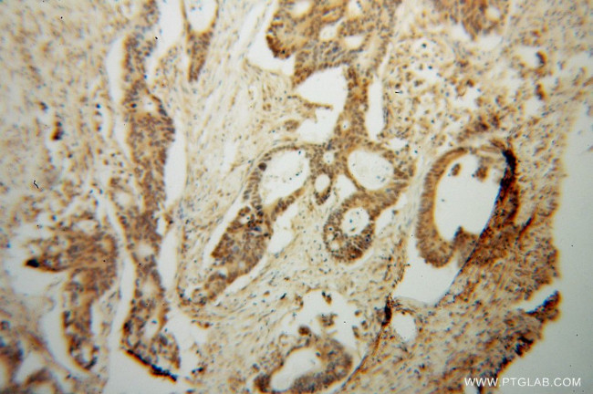 PDE8A Antibody in Immunohistochemistry (Paraffin) (IHC (P))