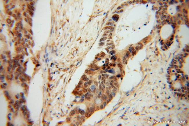 PDE8A Antibody in Immunohistochemistry (Paraffin) (IHC (P))