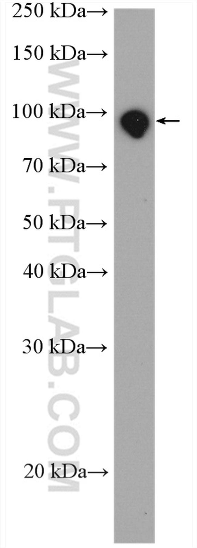 PDE8A Antibody in Western Blot (WB)