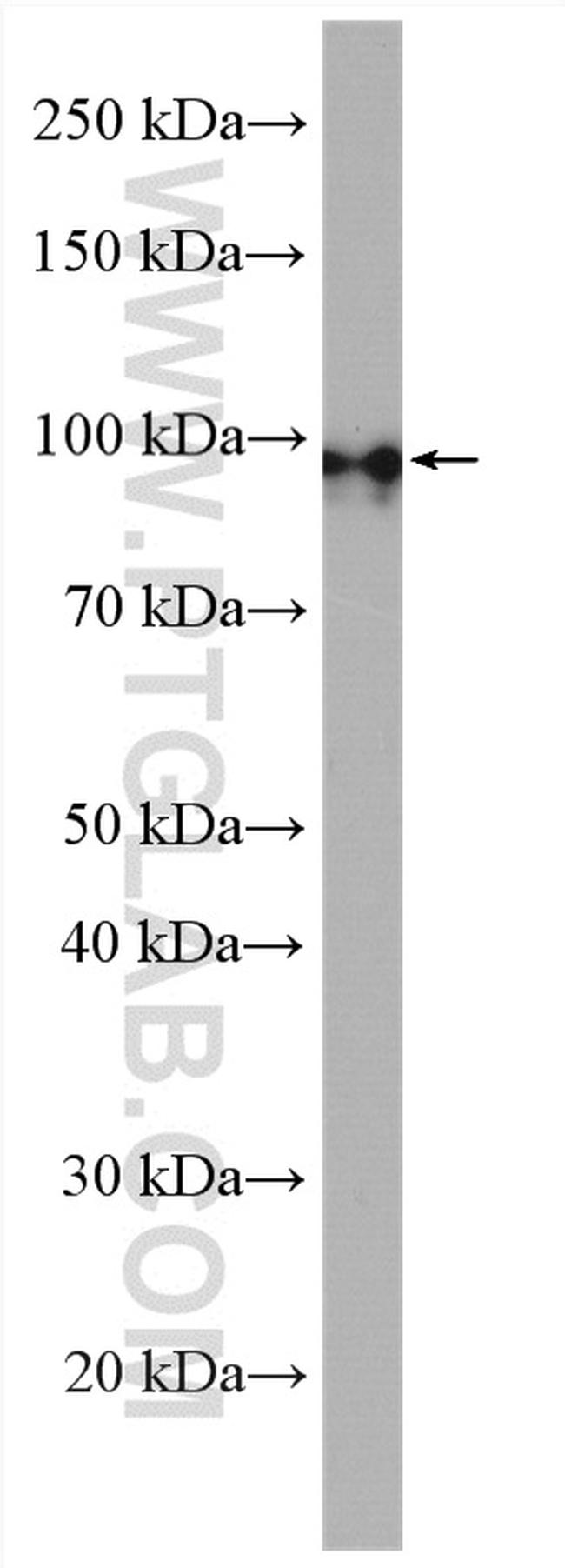 PDE8A Antibody in Western Blot (WB)