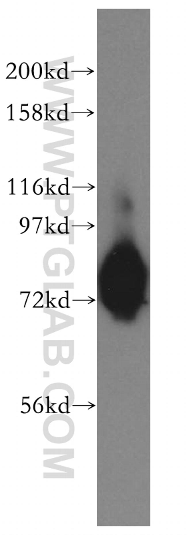 GALNT7 Antibody in Western Blot (WB)