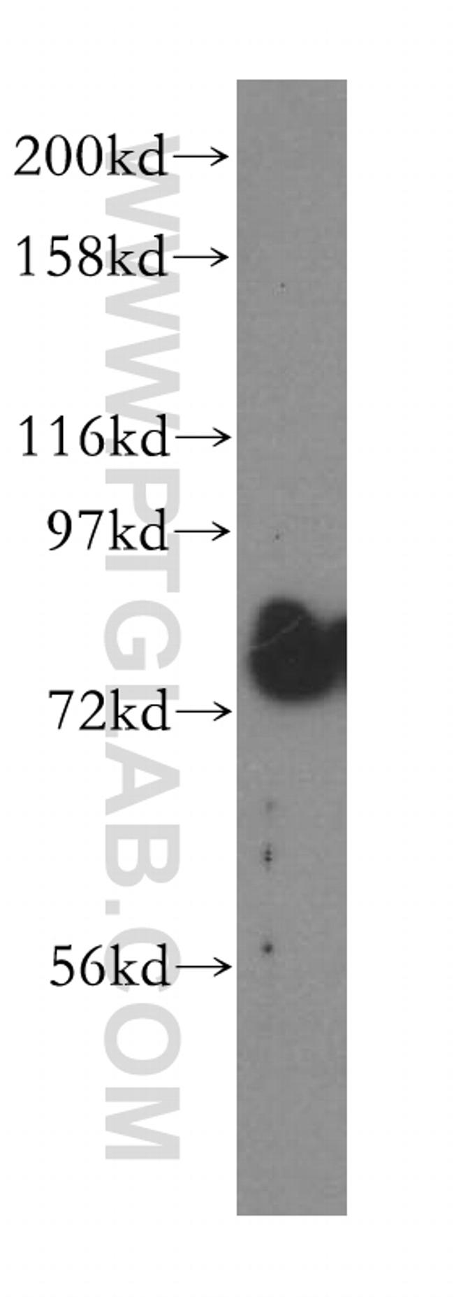 GALNT7 Antibody in Western Blot (WB)