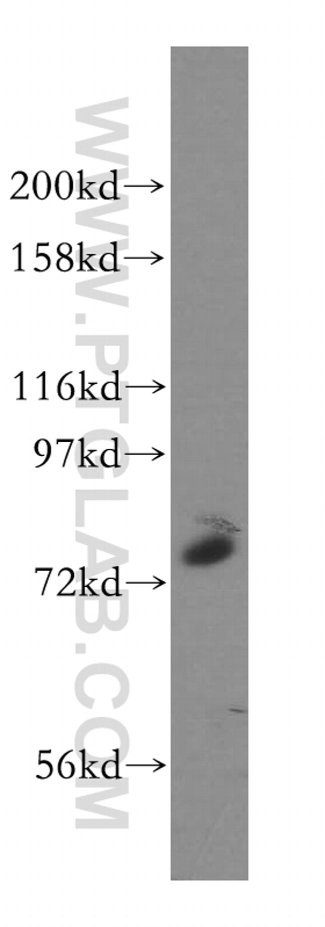 GALNT7 Antibody in Western Blot (WB)