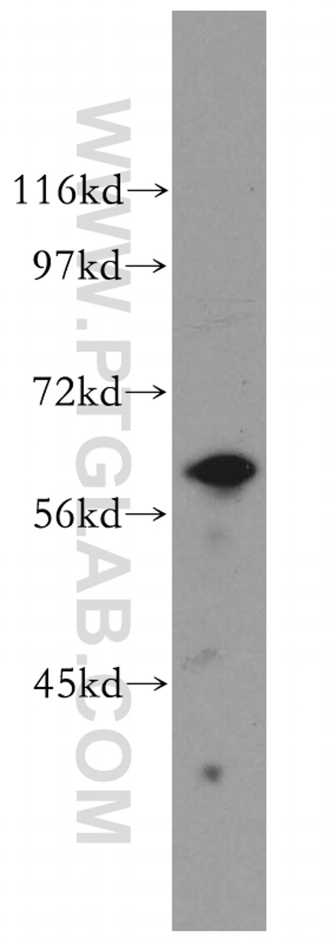 KPNA5 Antibody in Western Blot (WB)