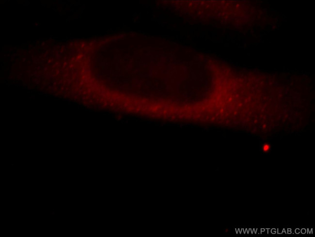 MICAL2 Antibody in Immunocytochemistry (ICC/IF)