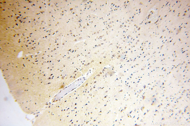 MICAL2 Antibody in Immunohistochemistry (Paraffin) (IHC (P))