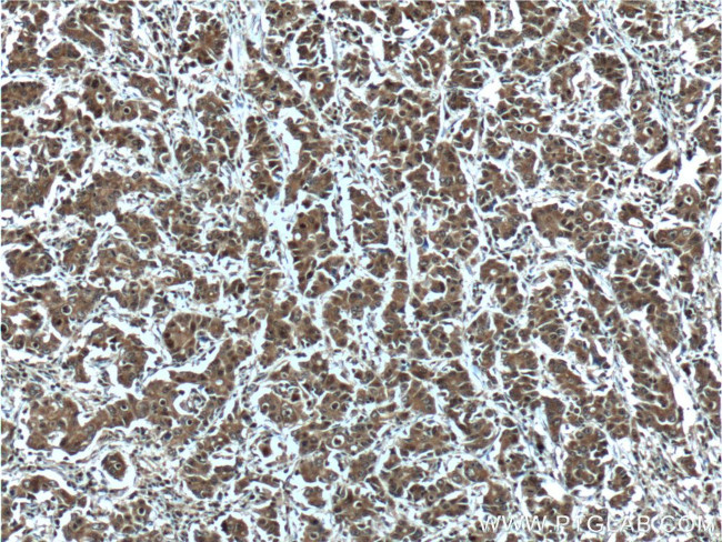 MICAL2 Antibody in Immunohistochemistry (Paraffin) (IHC (P))
