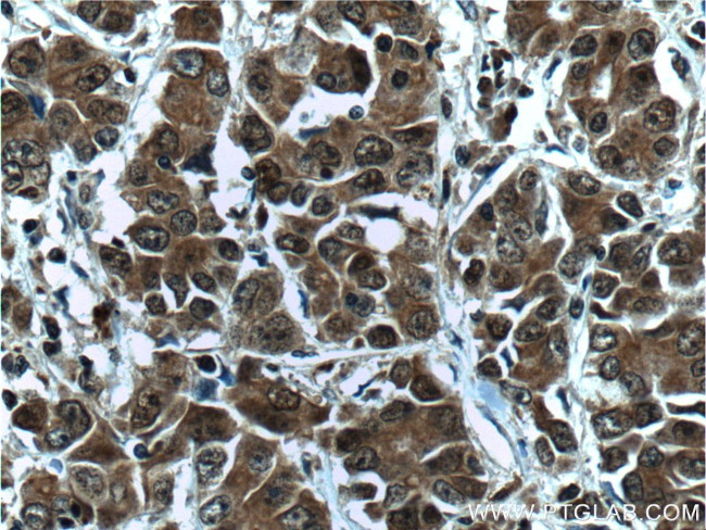 MICAL2 Antibody in Immunohistochemistry (Paraffin) (IHC (P))