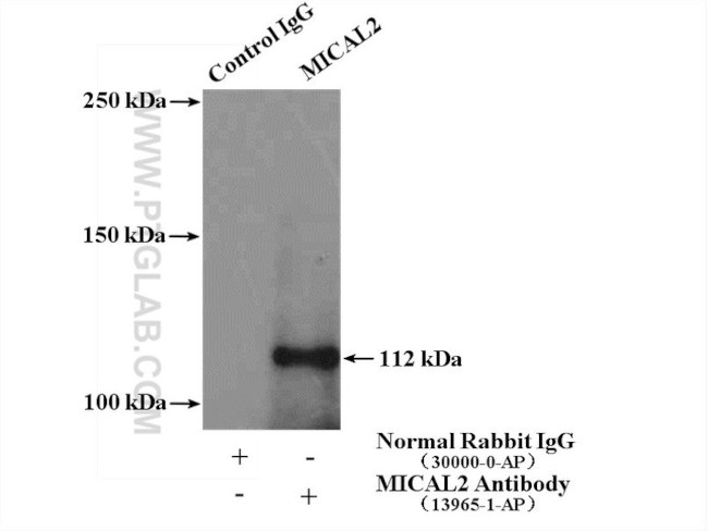 MICAL2 Antibody in Immunoprecipitation (IP)