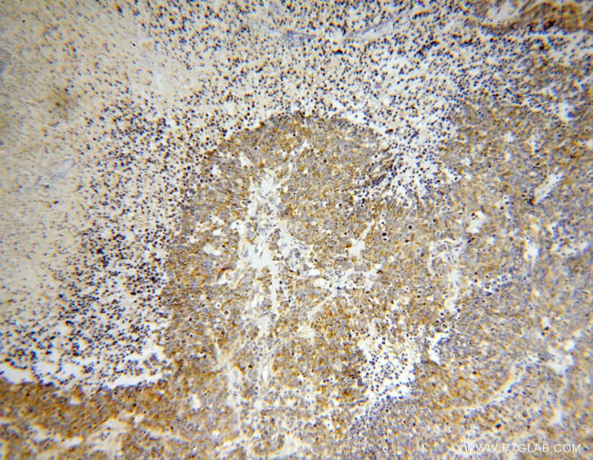 ZnT7 Antibody in Immunohistochemistry (Paraffin) (IHC (P))