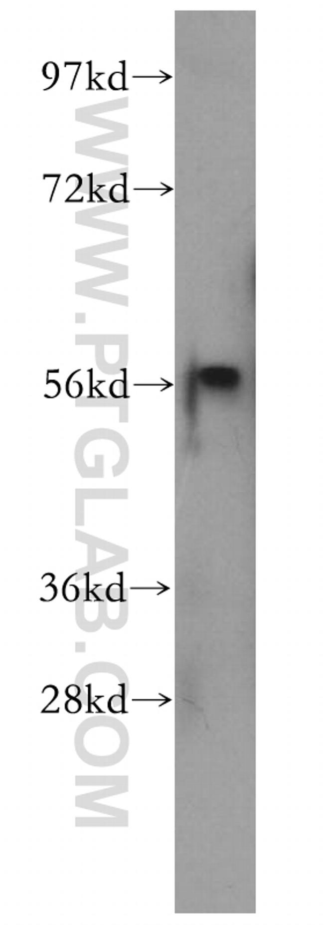 DDI1 Antibody in Western Blot (WB)