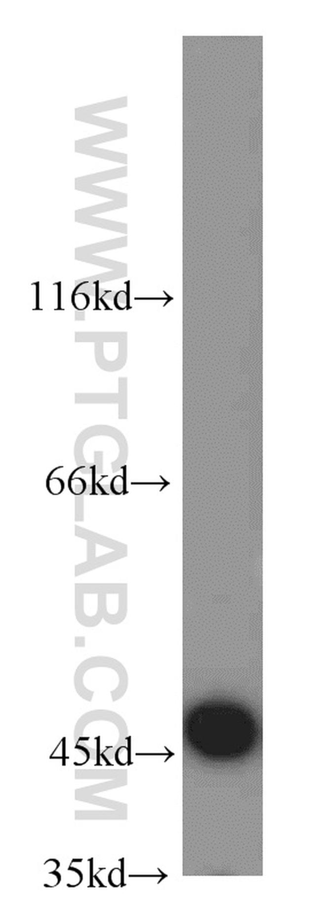 DDI1 Antibody in Western Blot (WB)