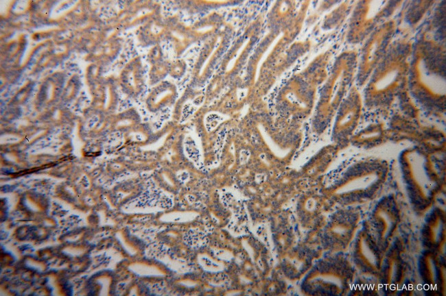 HSPA1L Antibody in Immunohistochemistry (Paraffin) (IHC (P))