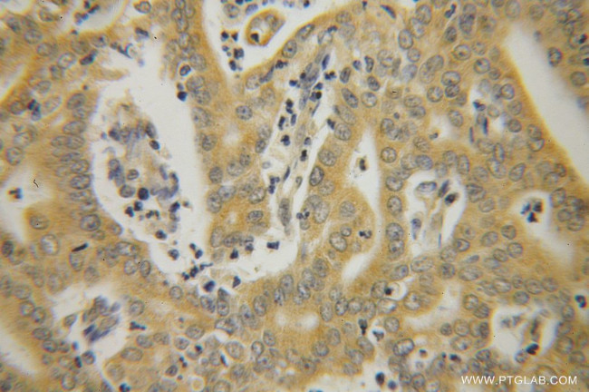 HSPA1L Antibody in Immunohistochemistry (Paraffin) (IHC (P))