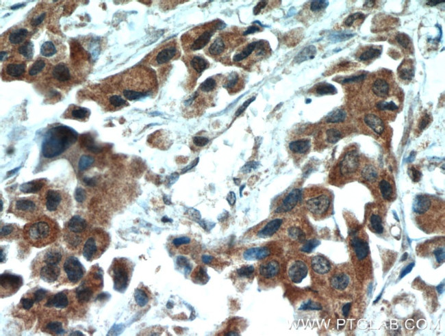 HSPA1L Antibody in Immunohistochemistry (Paraffin) (IHC (P))